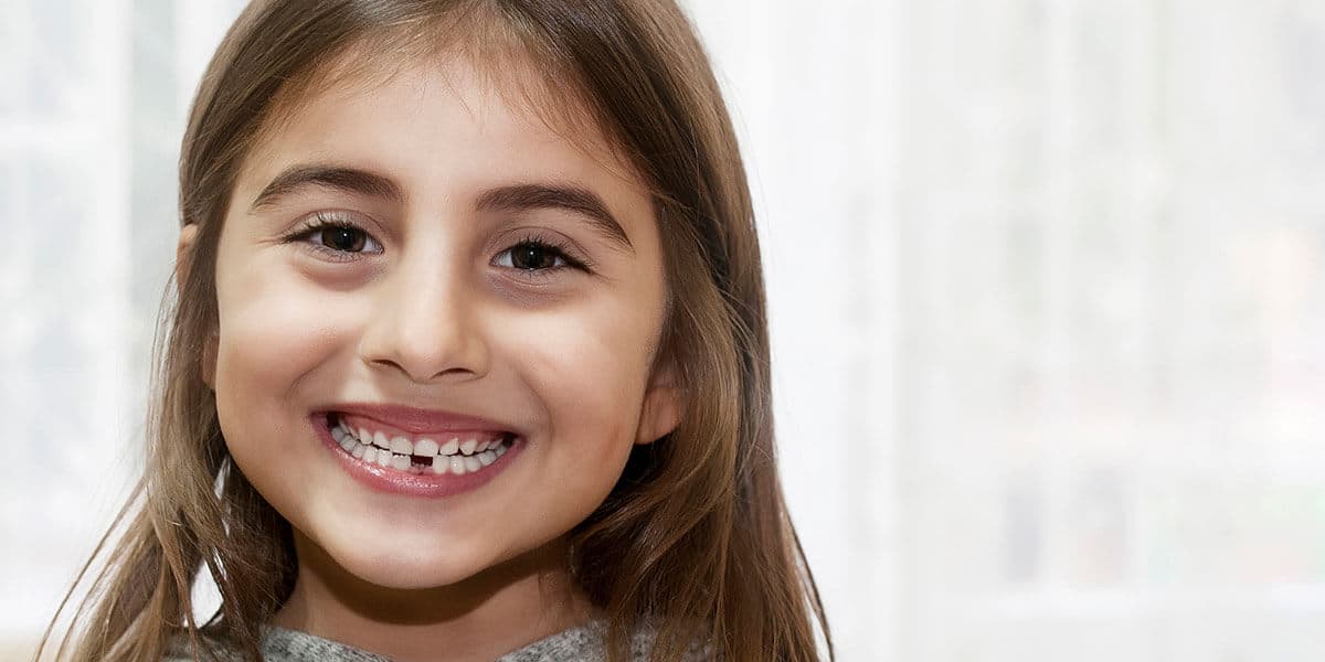 Interceptive Orthodontics Image